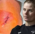 Lotte Kopecky deelt schrikwekkende update na valpartij