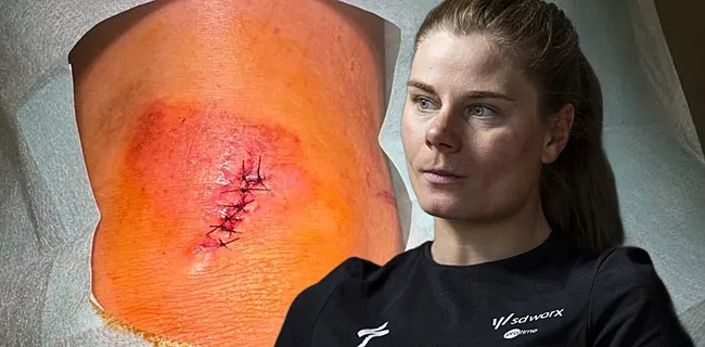 Lotte Kopecky deelt schrikwekkende update na valpartij
