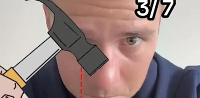 'Hamster' Evenepoel gaat los op TikTok na operatie